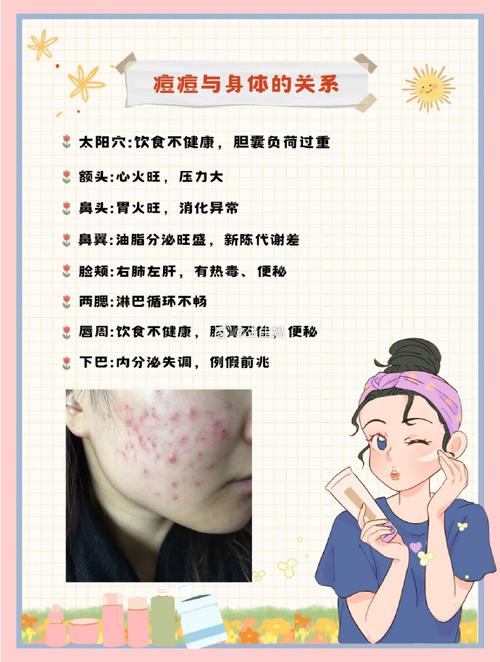 满脸痘痘怎么调理？内调外养，告别烦人痘痘肌！