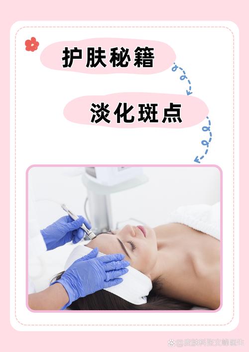 满脸雀斑如何淡化？这几个小技巧你一定要知道！