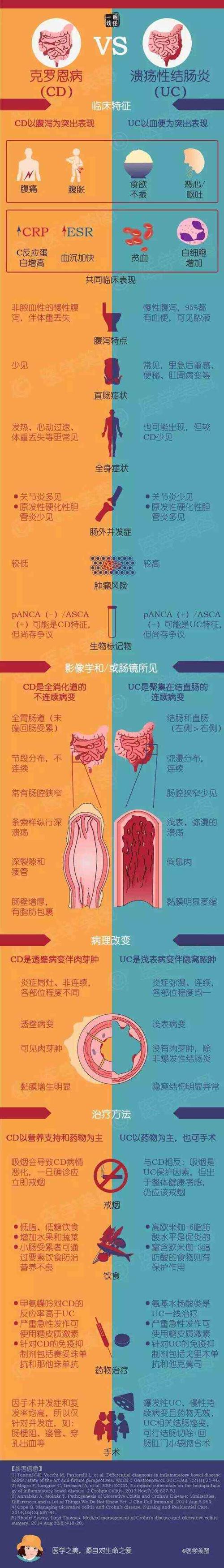克罗恩病是什么病？这篇文章让你一看就明白！