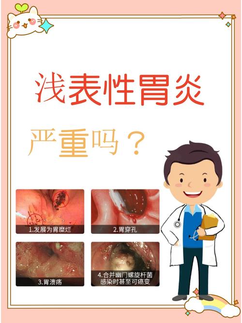 糜烂性胃炎会癌变吗？这篇文章告诉你答案！