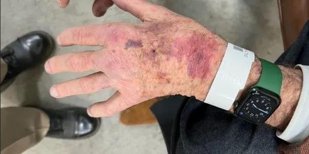 佩洛西只有一个丈夫吗？细数她老公的“传奇”经历