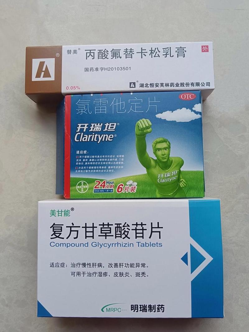 皮肤过敏的药怎么吃？不同症状的用药建议