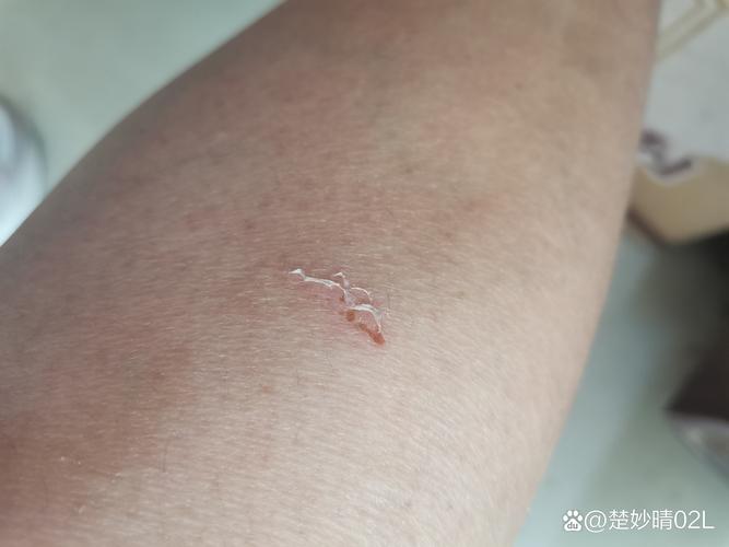 登巴巴断腿事件始末：究竟是谁踢断了他的腿？