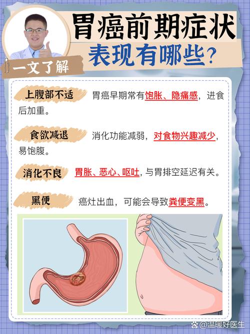 糜烂性胃炎是癌前病变吗？别慌，先了解清楚