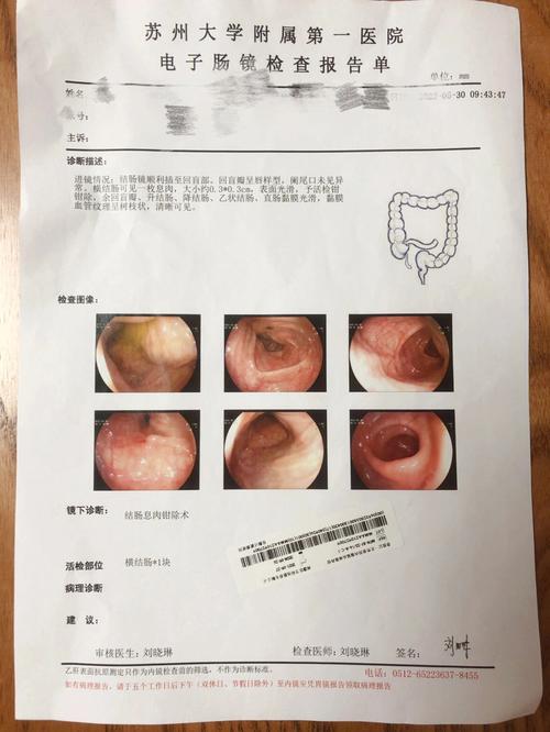糜烂性胃炎是癌前病变吗？别慌，先了解清楚