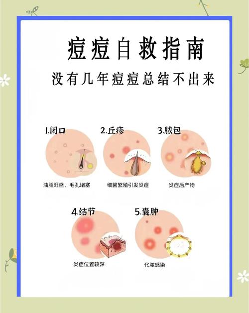 急救！满脸长痘痘怎么调理才能快速消下去？