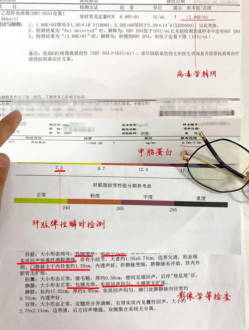 体检肝功能查哪些项目？快速了解肝脏健康状况