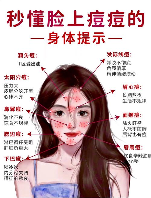 急救！满脸长痘痘怎么调理才能快速消下去？