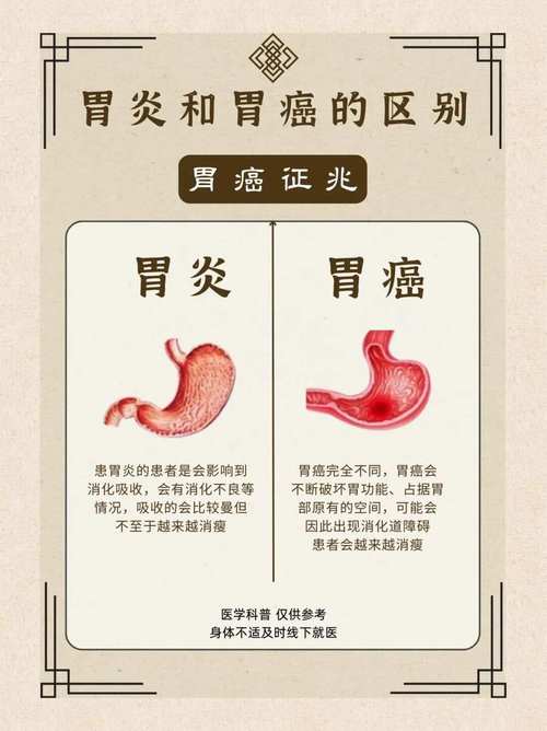 糜烂性胃炎是癌前病变吗？别慌，先了解清楚