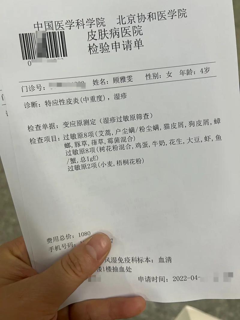 做过敏原检测需要多少钱？医院、项目影响价格吗？