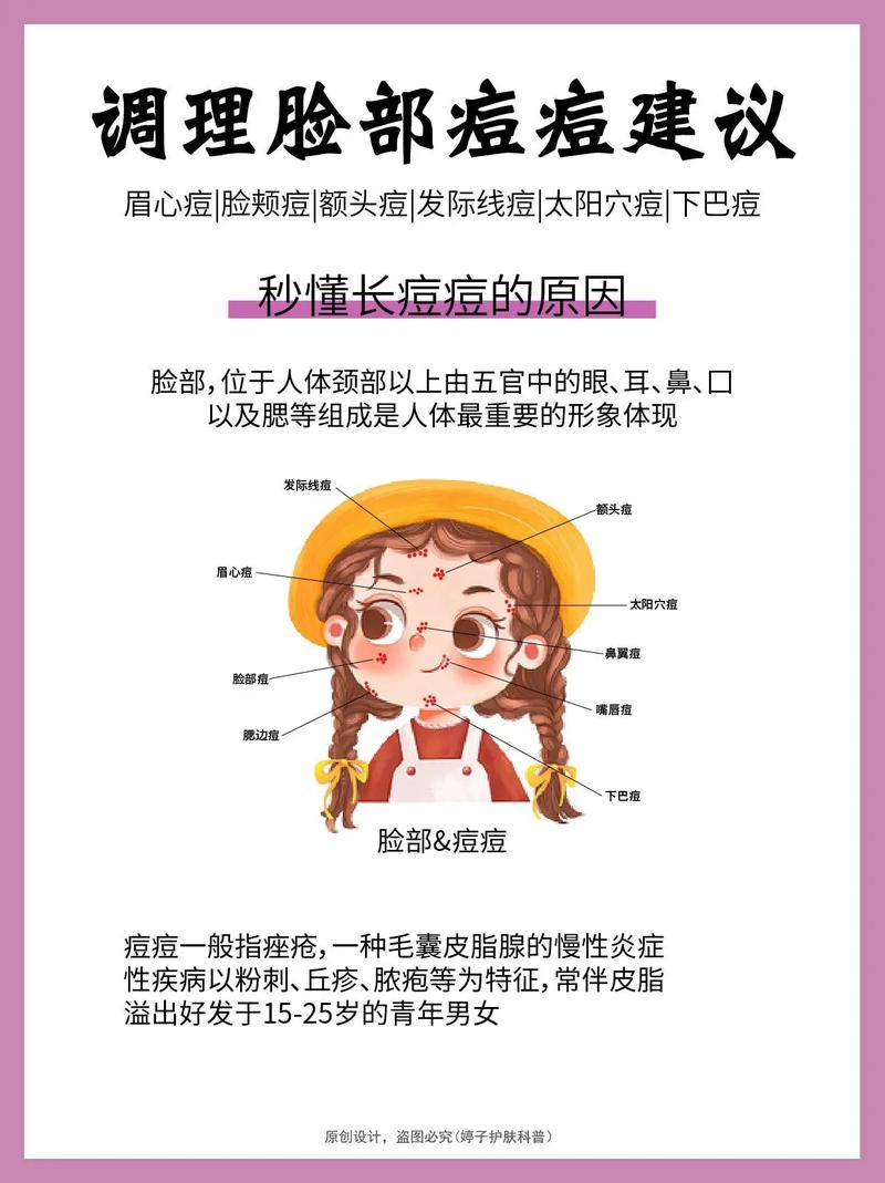 脸上长满痘痘是什么原因？专家教你如何摆脱痘痘