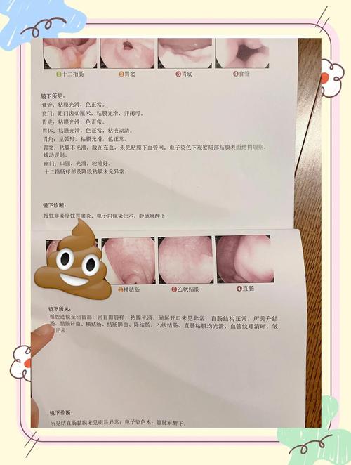 做完活检，结果一般多久出来？不同类型活检出结果时间差异大吗？