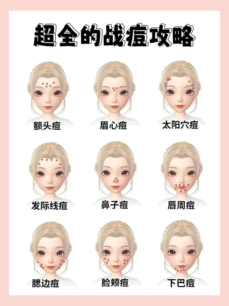脸上长满痘痘是什么原因？专家教你如何摆脱痘痘