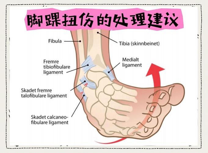 俞长栋最新伤情通报：脚踝扭伤多久能好？