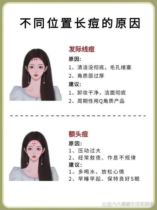 脸上长满痘痘是什么原因？专家教你如何摆脱痘痘