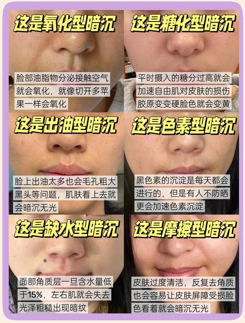 芬兰人肤色偏黄的真正原因是什么？