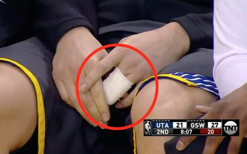 你的手指会脱臼吗？手指脱臼的常见原因及预防