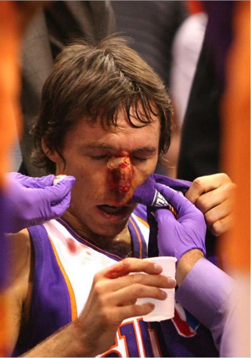 揭秘：纳什被谁撞飞？背后真相令人震惊