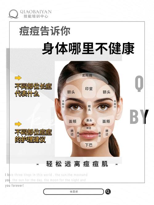脸上长满痘痘是什么原因？专家教你如何摆脱痘痘
