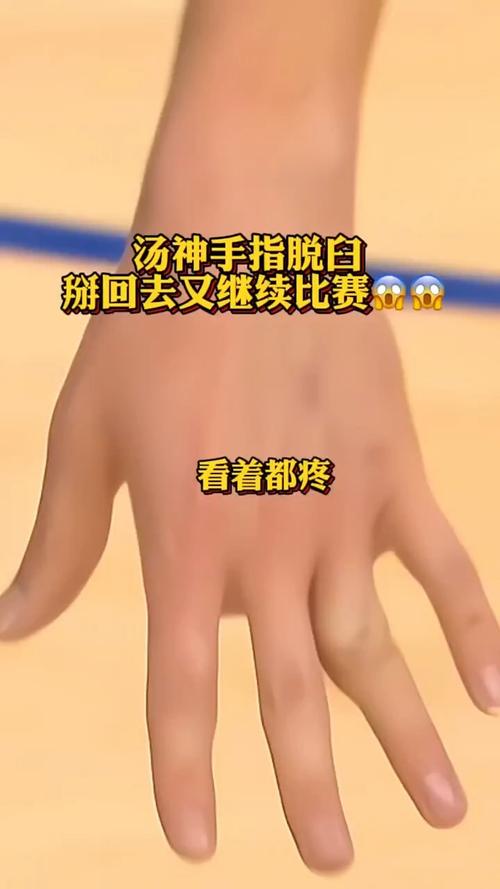 你的手指会脱臼吗？手指脱臼的常见原因及预防