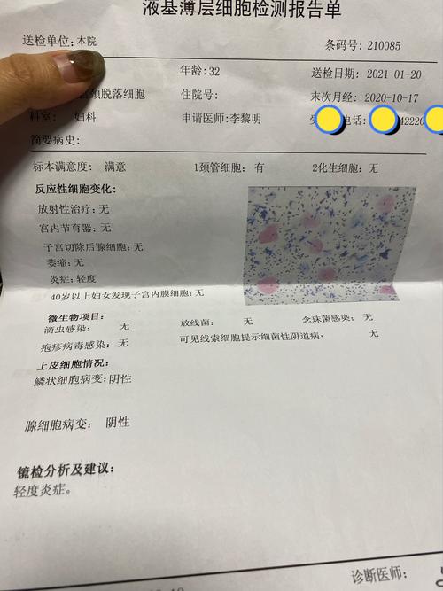 做完活检，结果一般多久出来？不同类型活检出结果时间差异大吗？