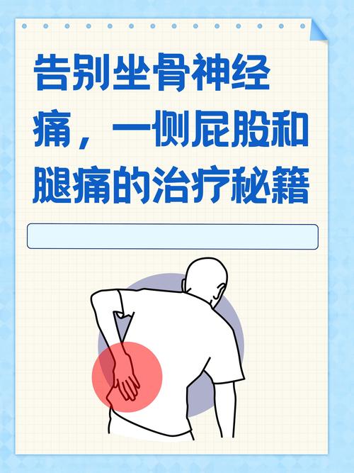 坐骨神经痛是哪个部位疼?日常避痛实用小窍门!