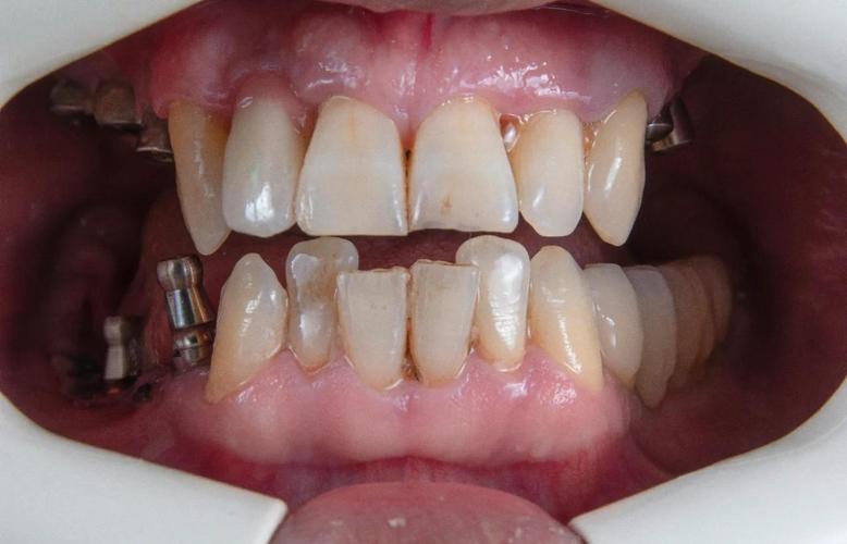 皮诺到底怎么选这三个关键点必须要注意