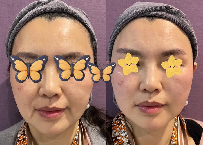 intz效果到底怎么样？(真实案例分享提升方法)