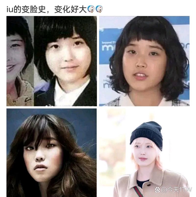 IU整容效果如何?三张对比照惊人变化展示!
