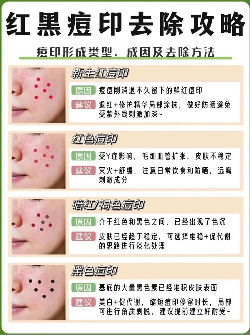 如何快速修复满脸痘坑？三大高效疗法帮你还原皮肤！