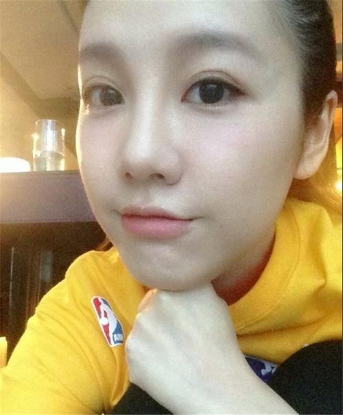 刘语熙整容前后变化揭秘！(曝光照片引发网友热议！)